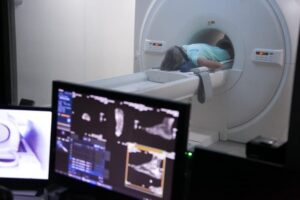 Timon: inaugurado em março, Centro de Imagem já realizou mais de 1,7 mil exames
