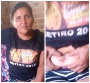 Prefeito médico do interior é acusado de esquecer gazes dentro de paciente; vídeo