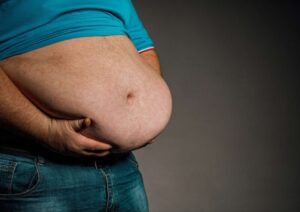 Dados inéditos mostram crescimento da obesidade no MA, doença que mata 70% das pessoas antes dos 50 anos
