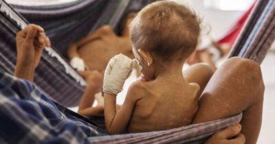 Maranhão tem 52 mil crianças com risco de desnutrição
