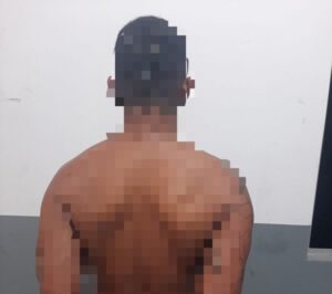 Polícia Civil prende homem suspeito de atirar no rosto de PM durante assalto