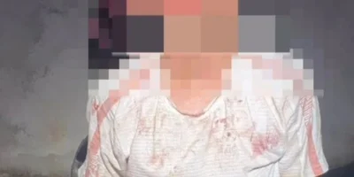 Mulher fica desacordada após agressão do marido em Imperatriz; ele foi preso