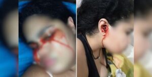 Jovem Que Sangrava Por Nariz, Boca E Ouvidos Agora ‘Chora’ Sangue E Desafia Médicos Em Santos