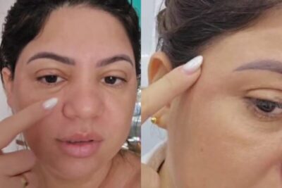Pacientes denunciam dona de clínica por erros em procedimentos estéticos