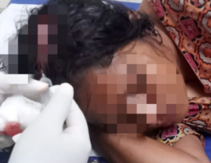 Policial tenta matar esposa com golpe de facão na cabeça e foge no interior do MA