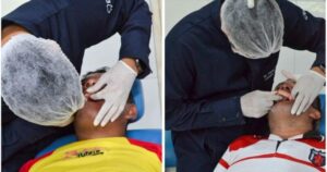 Em São Benedito do Rio Preto, 700 pessoas são beneficiadas com próteses dentárias