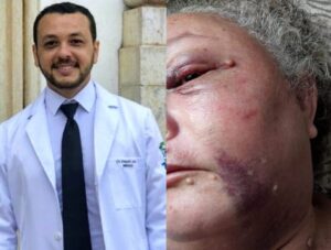 Médico é acusado pela irmã de espancar a própria mãe em Codó