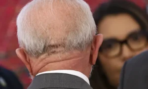 Lula realiza exames em Brasília; quadro é estável e presidente pode retornar ao trabalho