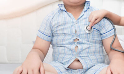 O peso do futuro: obesidade infantil atinge 26% das crianças no Maranhão