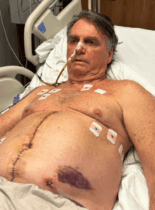 Após intimação, Bolsonaro tem piora no quadro de saúde