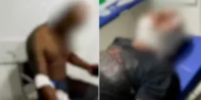 Três pessoas ficam feridas após ataque de pitbulls em Paço do Lumiar
