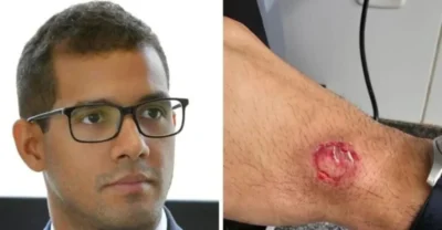Homem invade fórum e morde juiz no braço em Bom Jardim