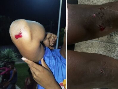 Jovens vítimas de racismo e homofobia na Baixada Maranhense registram denúncia na Delegacia de Combate a Crimes Raciais