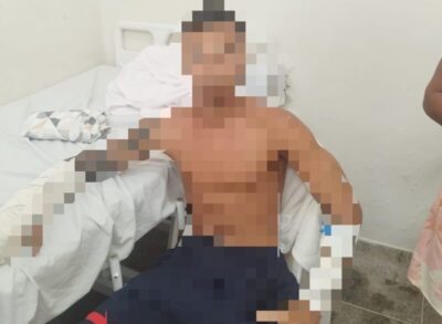 Investigado por roubo a residência é preso dentro de hospital de São Luís