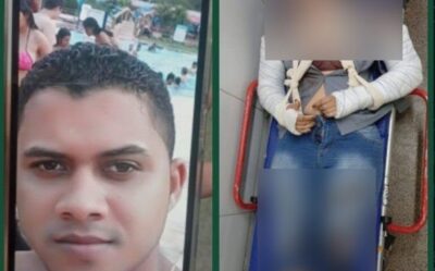 Mulher é espancada pelo ex e tem os dois braços quebrados em São Luís