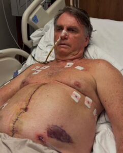 Bolsonaro completa uma semana pós-cirurgia com ‘pressão controlada’, mas segue na UTI sem previsão de alta