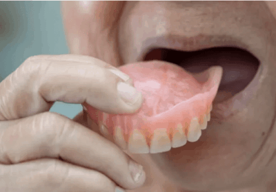 Prefeitura de São Vicente Férrer contrata empresa para confecção de dentaduras