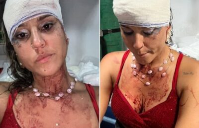 Mulher relata que foi agredida por policiais militares em bloco carnavalesco