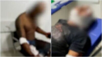 Ataque de pitbulls deixa três pessoas feridas em Paço do Lumiar no Maranhão